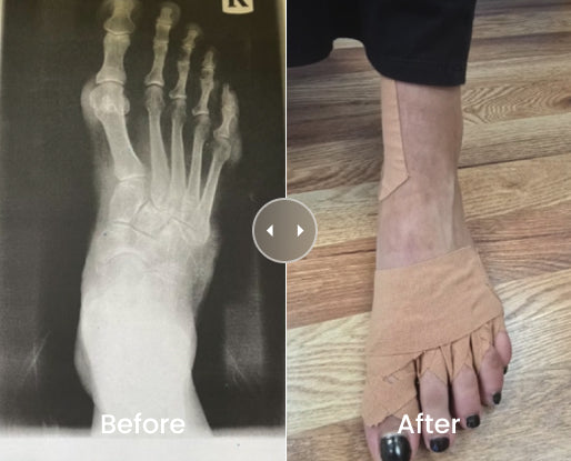 Before & After Result