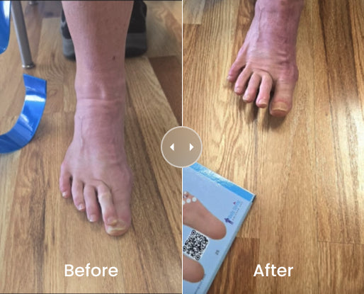 Before & After Result